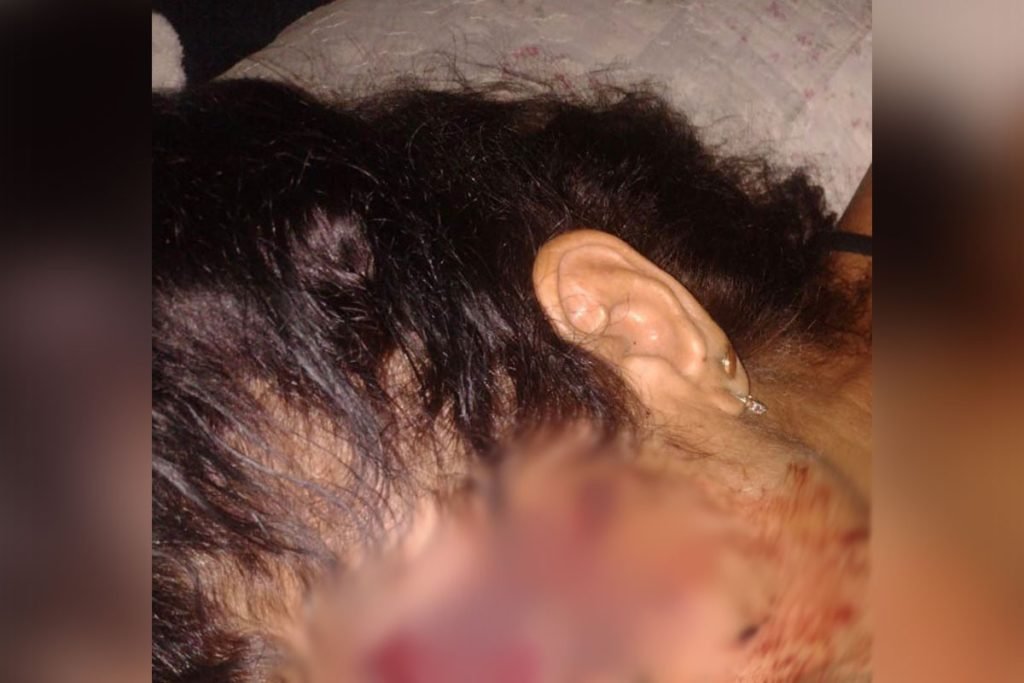 Após denúncia de vizinhos, filho é preso por agredir a própria mãe