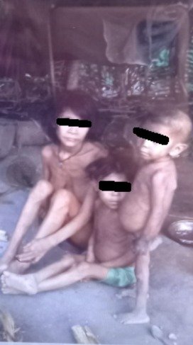 Crianças indígenas Yanomami ficaram sem medicamentos por conta de esquema de corrupção