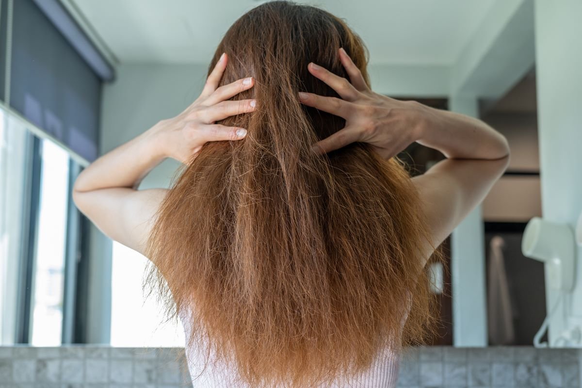 Foto colorida de mulher de costas com o cabelo ressecado - Metrópoles