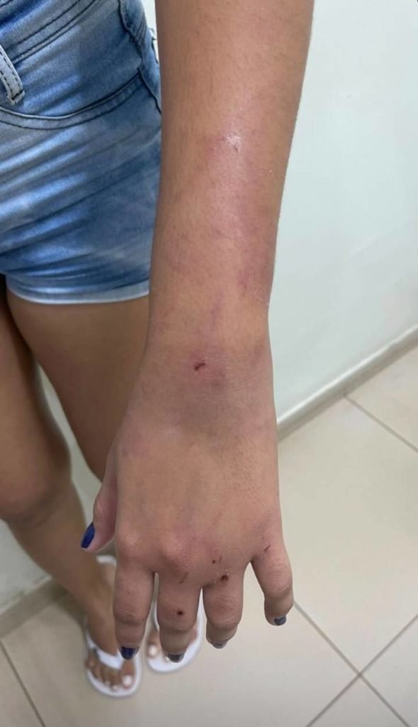 mulher agredida goiania namorado