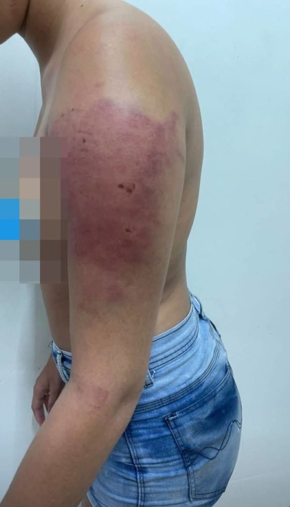 agressao namorado goiania espancamento