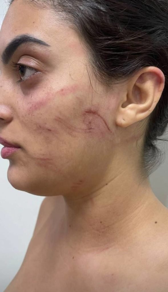 jovem agredida goiania namorado