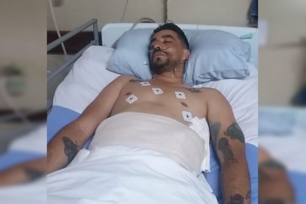 Foto-de-um-homem-entubado-deitado-em-uma-maca