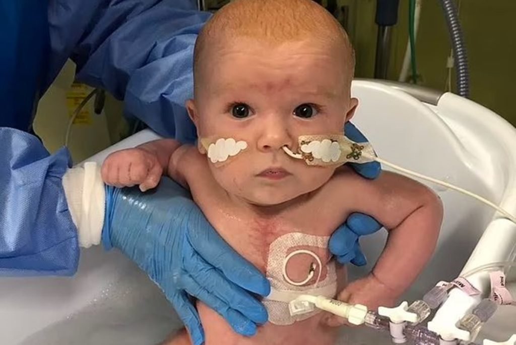 Foto colorida de recém-nascido conectado à tubos
