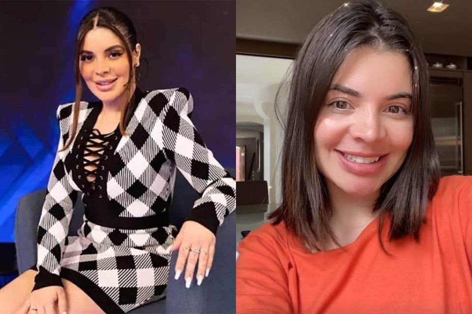 Na imagem, duas fotos justapostas da humorista Gkay. Na esquerda, ela com preenchimento labial; na direita, após ter tirado o procedimento - Metrópoles