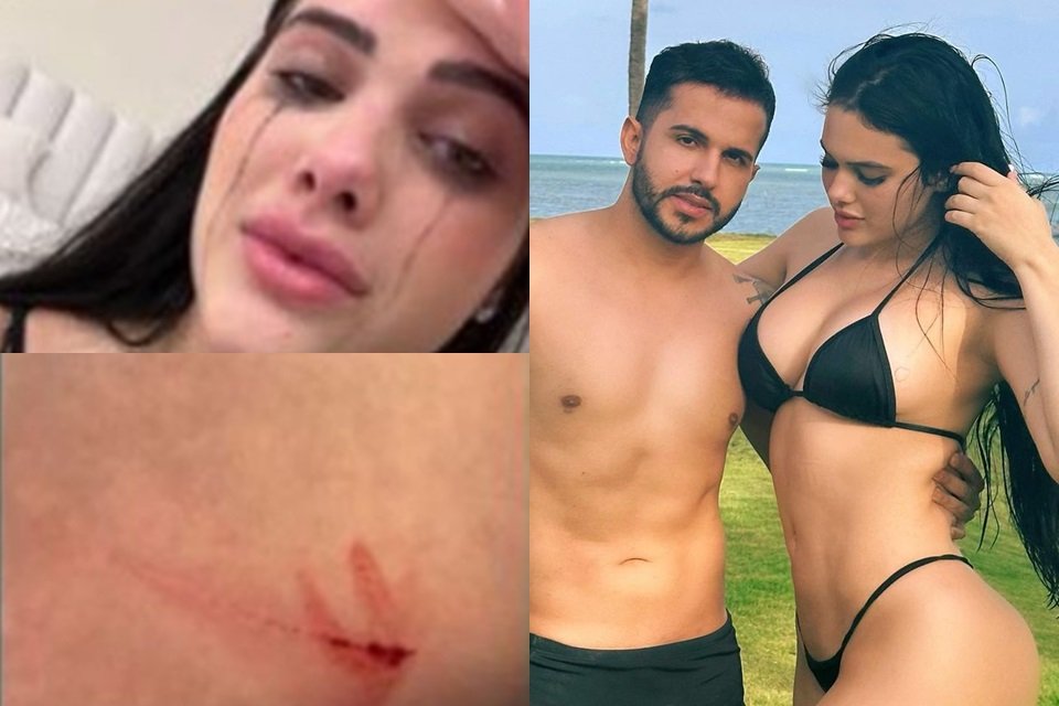 Emily Garcia expõe suposta agressão de Babal Guimarães (Reprodução/Instagram)