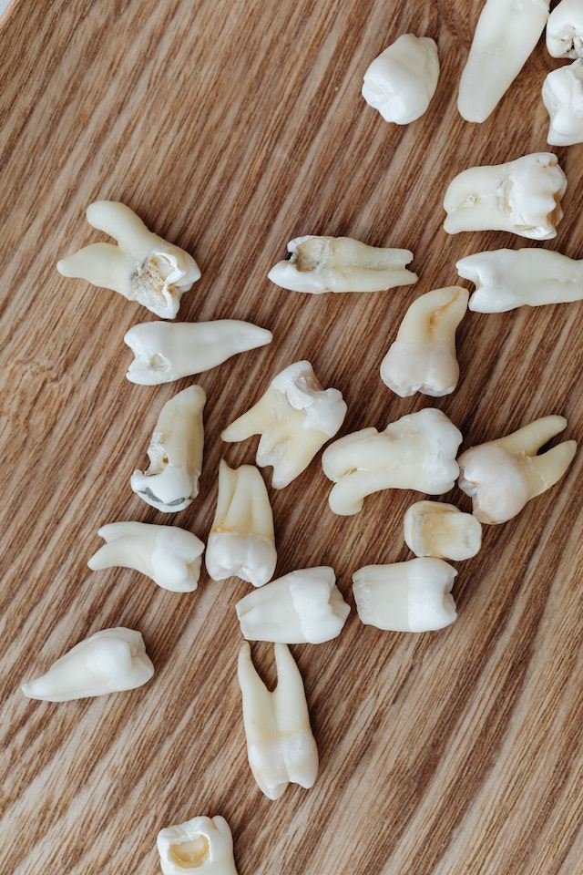 Dentes espalhados em mesa - Metrópoles
