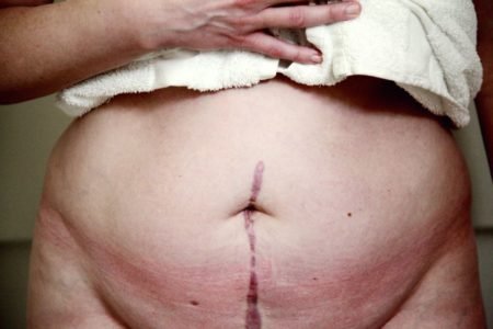 Me Too Brasil se mobiliza para tornar violência obstetrícia crime