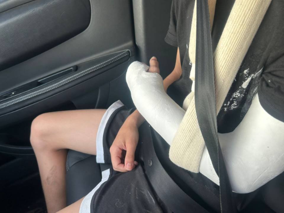 adolescente com braço engessado
