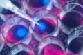 Imagem colorida HIV transplante de células tronco - Metrópoles