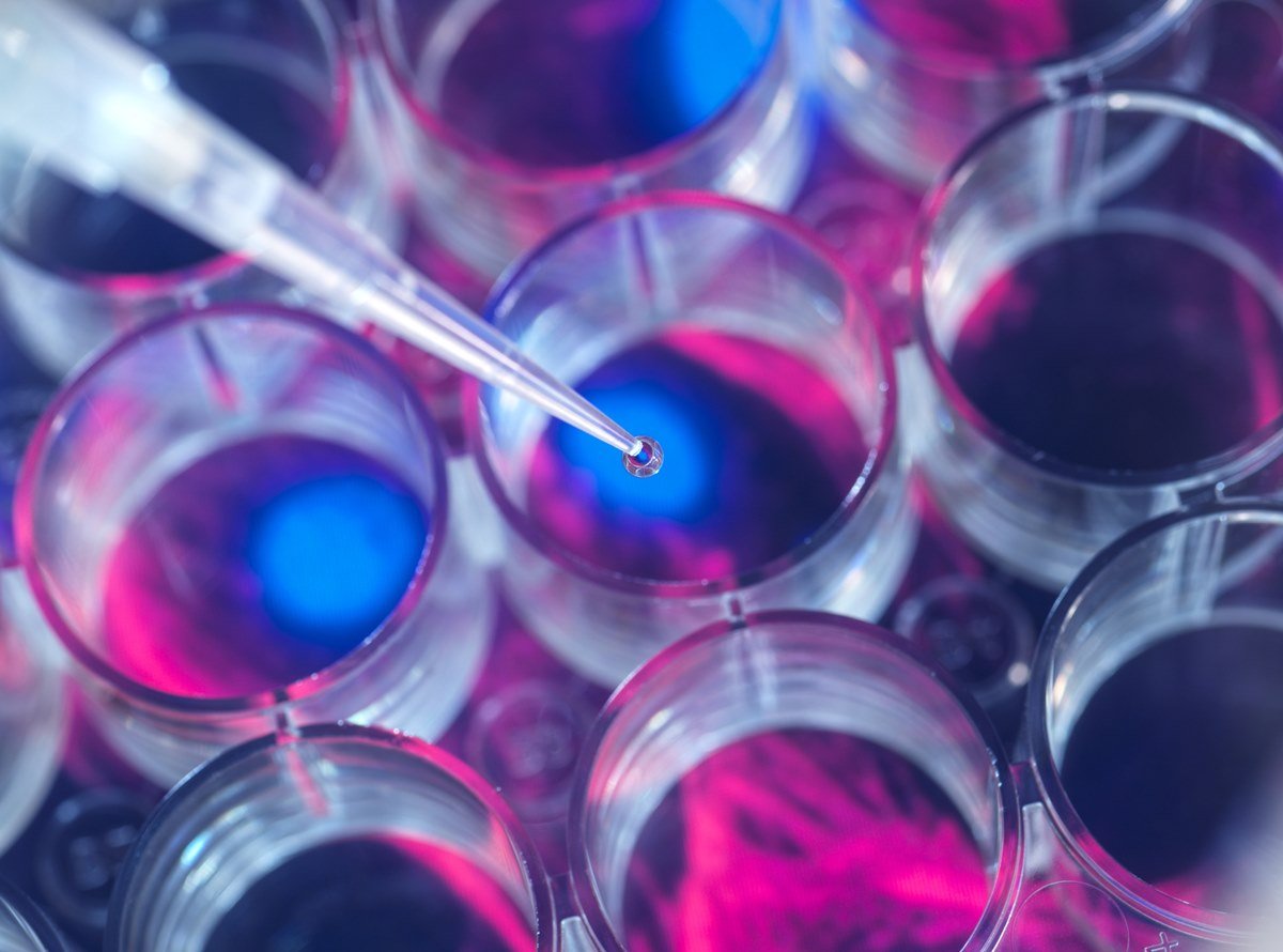 Imagem colorida HIV transplante de células tronco - Metrópoles