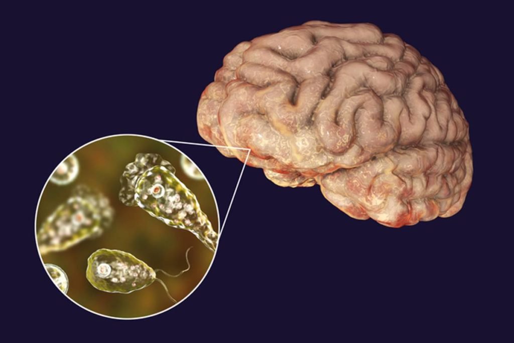 Desenho colorido de ameba comedora de cérebro instalada no órgão