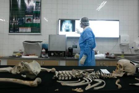 Ossada encontrada perto do Planalto estava com cr&acirc;nio e bra&ccedil;os separados |  Metr&oacute;poles