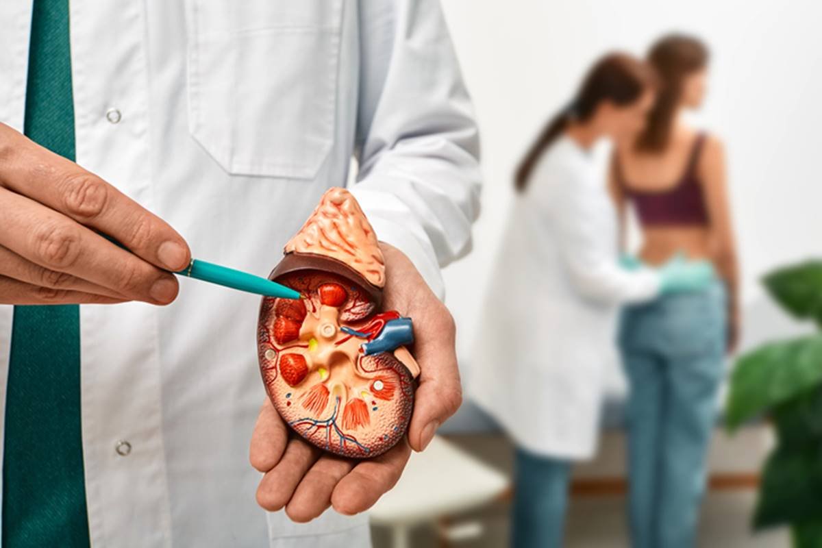 Imagem colorida de médico(a) mostrando modelo de rins com pedras e nofundo desfocado médica analisando paciente de costas