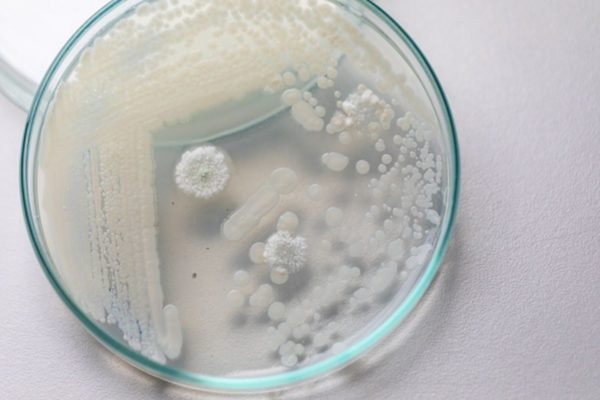 Imagem colorida: amostra de fungo - Metrópoles