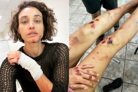 Débora Nascimento exibe ferimentos falsos em bastidores de Olhar Indiscreto, série da Netflix - Metrópoles