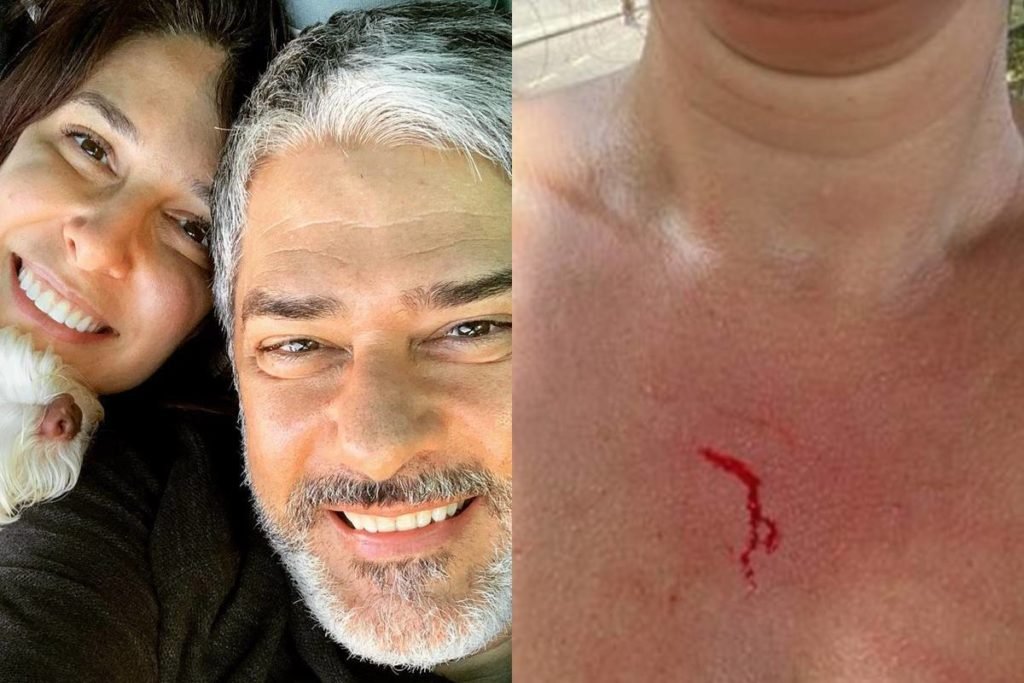 Natasha Dantas, mulher de Bonner, desabafa após ser roubada no RJ