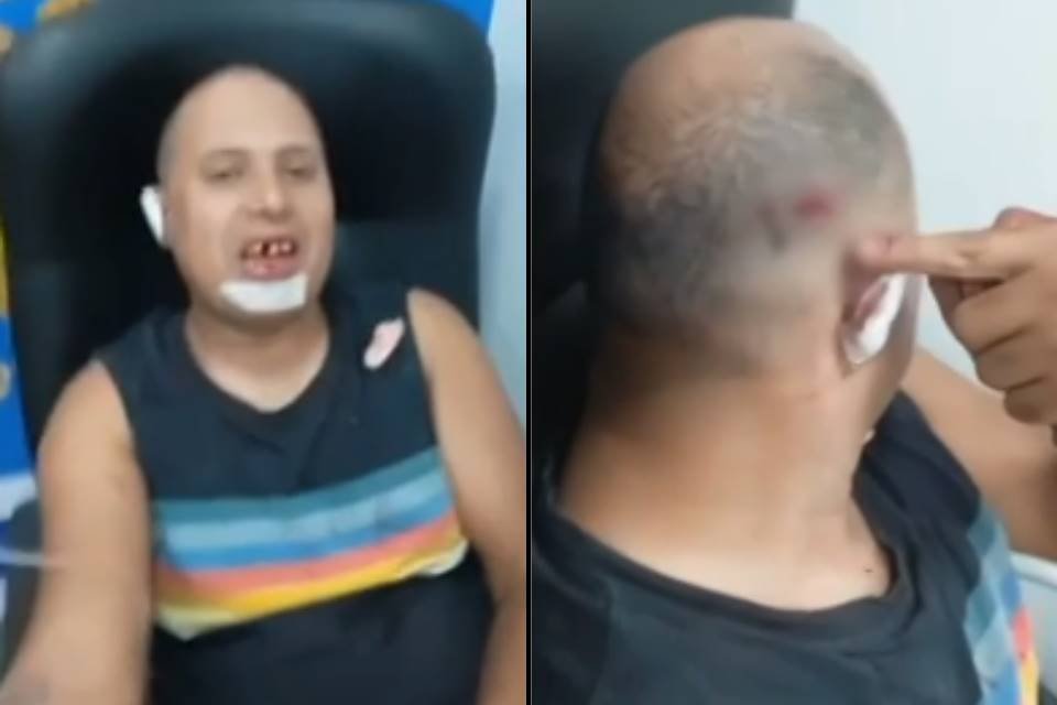 Foto colorida de homem agredido por dono de imóvel em Goiás - Metrópoles