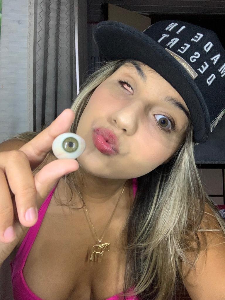 Raylla Fachin, 19, influencer who speaks openly about her ocular prostheses - Metrópoles