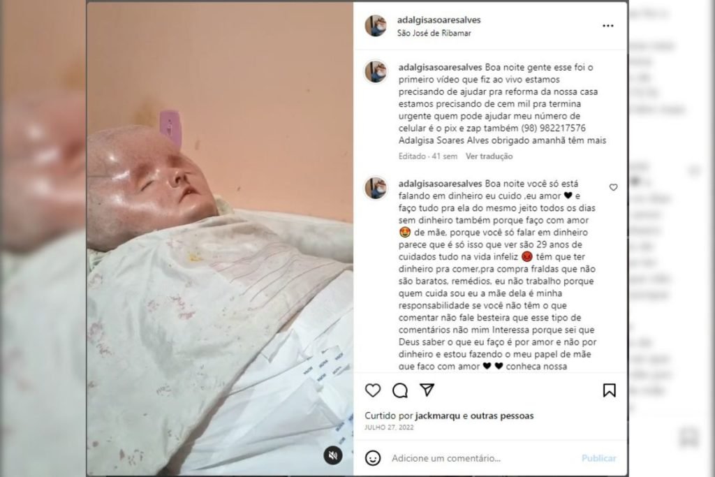 Printscreen colorido de publica&ccedil;&atilde;o em rede social que mostra jovem com hidrocefalia acamada
