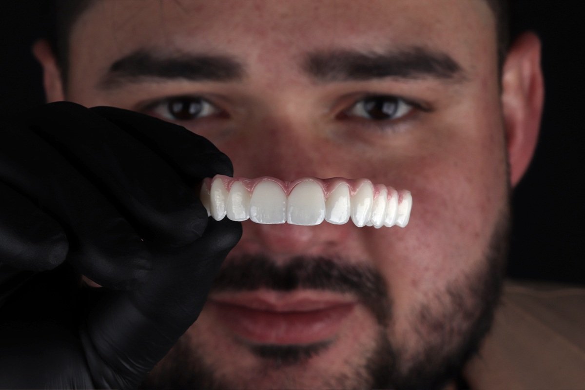 Foto colorida de um homem segurando uma arcada dentária para implante - metrópoles