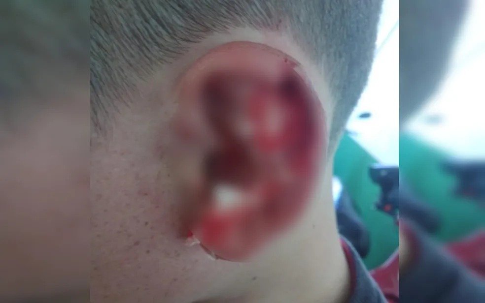 goias aluno autista pedaço orelha arrancada