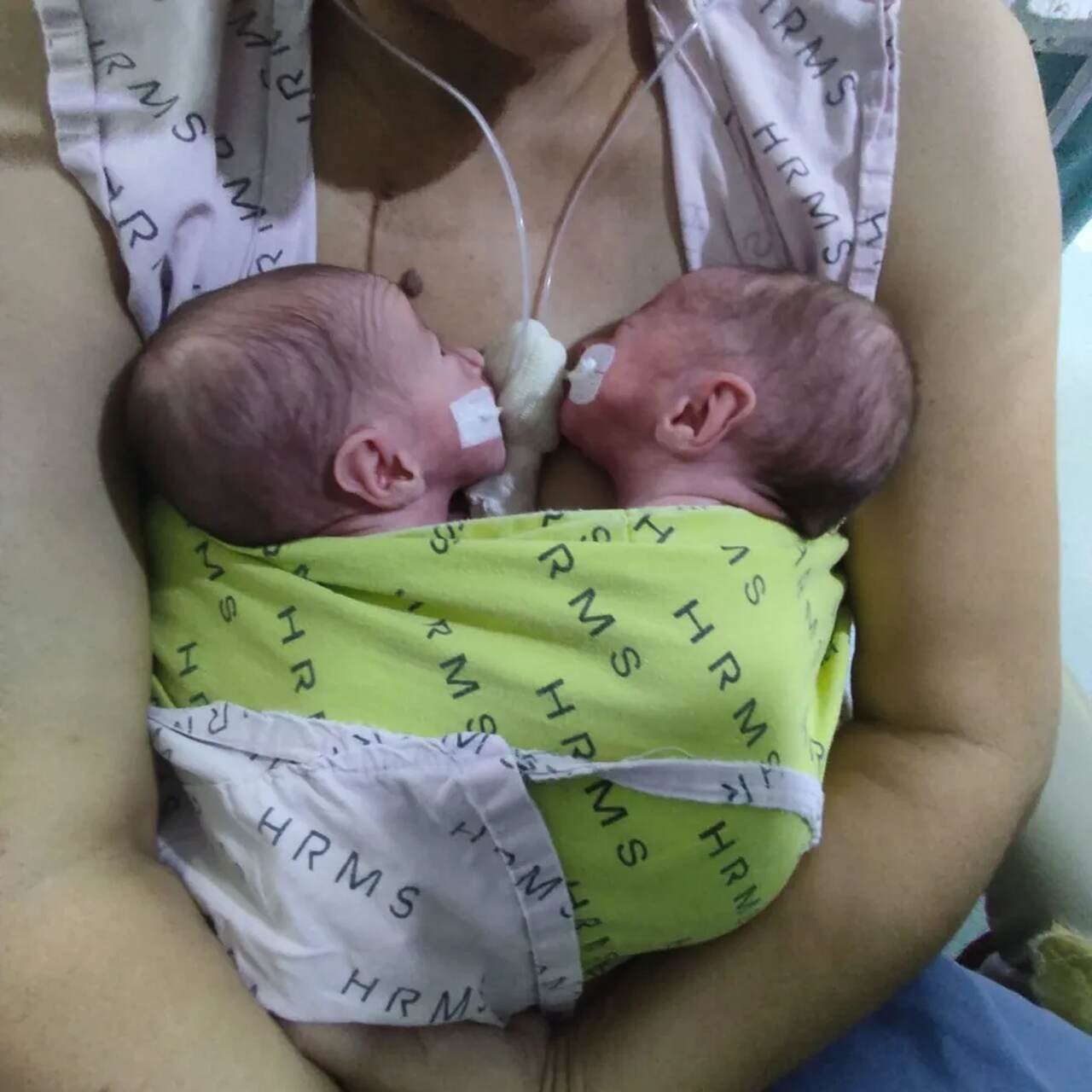 Na foto, uma mulher com dois bebês no colo - Metrópoles