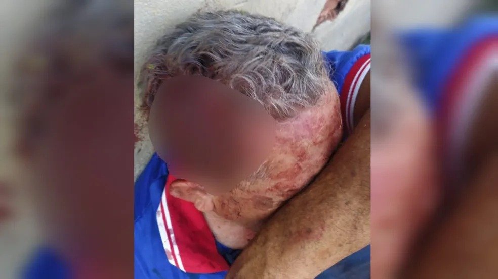 goias idoso tenta matar cunhado a marteladas