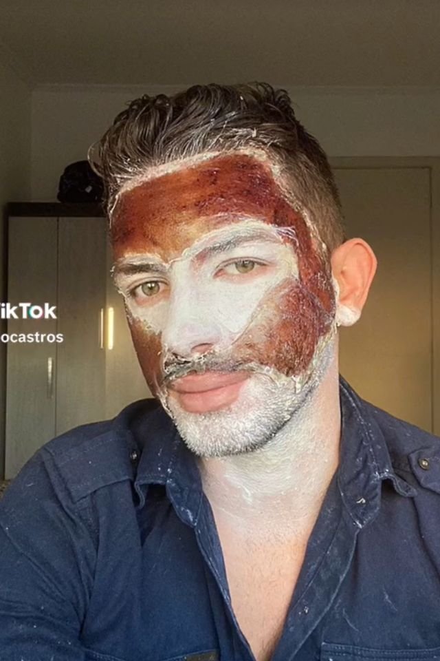 Peeling de fenol