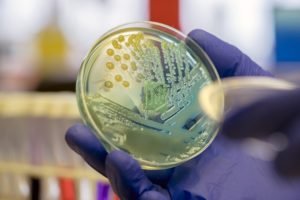 Foto mostra pesquisador segurando frasco com uma cultura de superbactérias - Metrópoles
