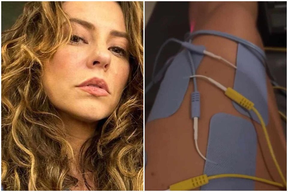 Montagem com duas fotos de Paolla Oliveira. Uma do rosto e outra do joelho da atriz - Metrópoles