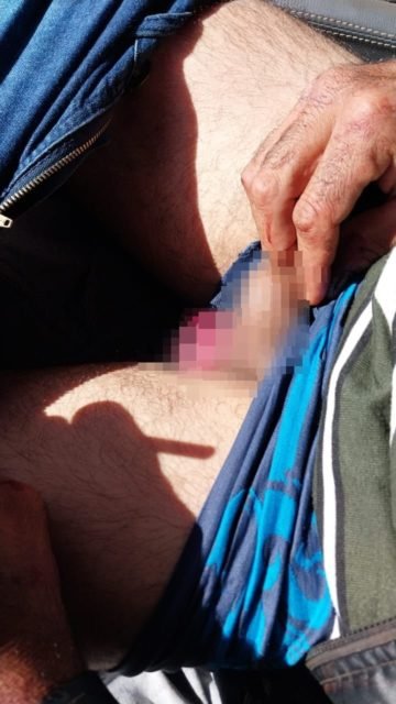 Foto borrada do testículo de homem vítima de violência no Entorno do DF