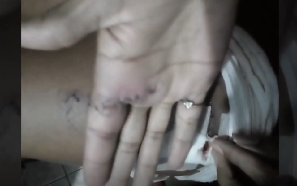 Foto colorida de uma mão com pontos - Metrópoles