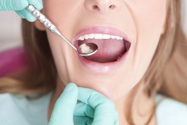 Foto de mulher com boca aberta sendo examinada por dentista - Metrópoles