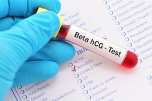Foto colorida: mão com luva azul segura exame de sangue sobre lista de testes - Metrópoles