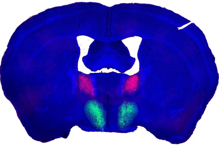 Imagem colorida de cérebro de camundongo em estudo da libido - Metrópoles