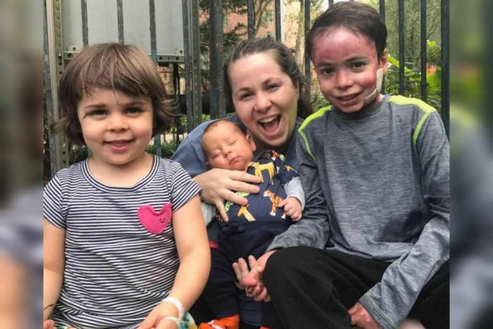 Foto mostra uma mãe com seus três filhos ao seu redor, um deles tem a pele afetada pela epidermólise bolhosa - Metrópoles