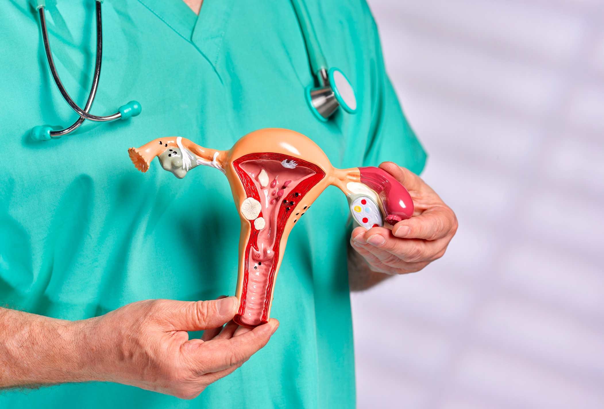 Médico segura escultura que imita um sistema reprodutivo feminino