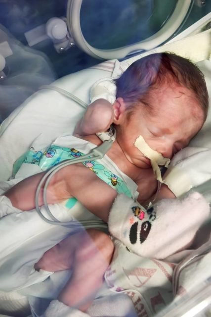 Foto colorida de bebê em incubadora - Metrópoles