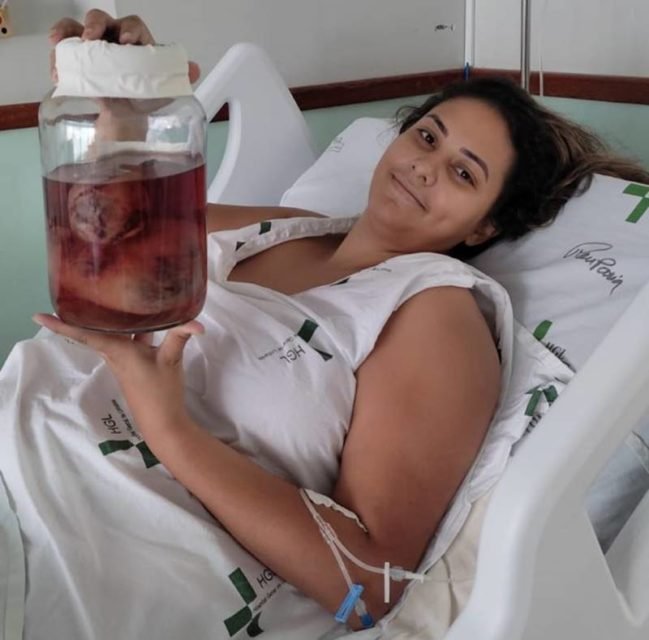 Foto de mulher deitada em maca de hospital segurando pote com tumores - Metrópoles