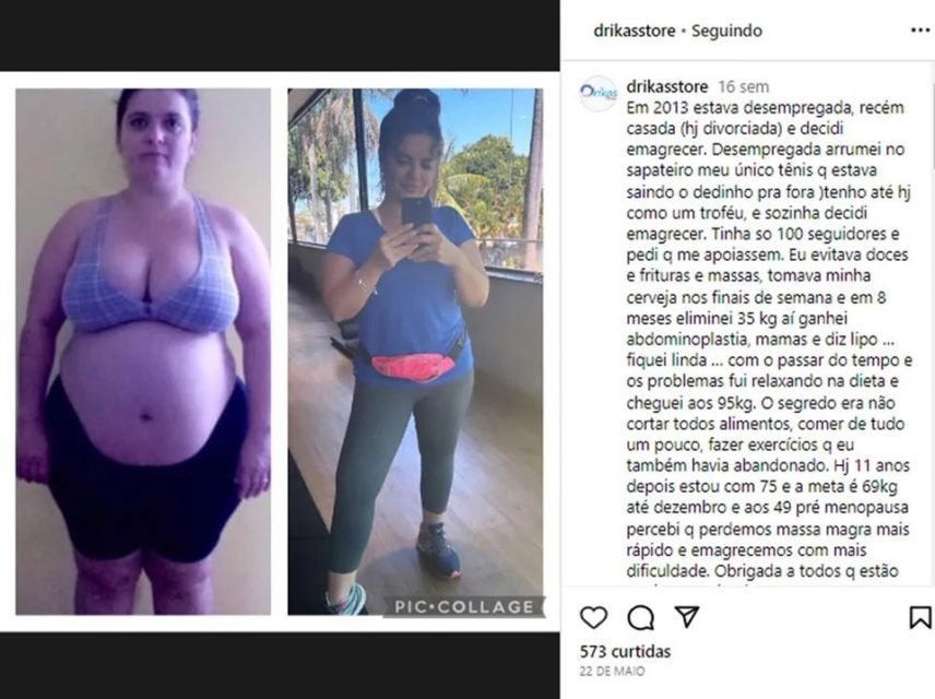 imagem colorida antes e depois adriana thyssen