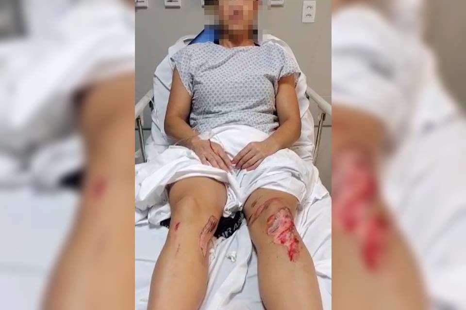 Mulher mostra ferimentos após ser alvo de tentativa de feminicídio no DF - Metrópoles