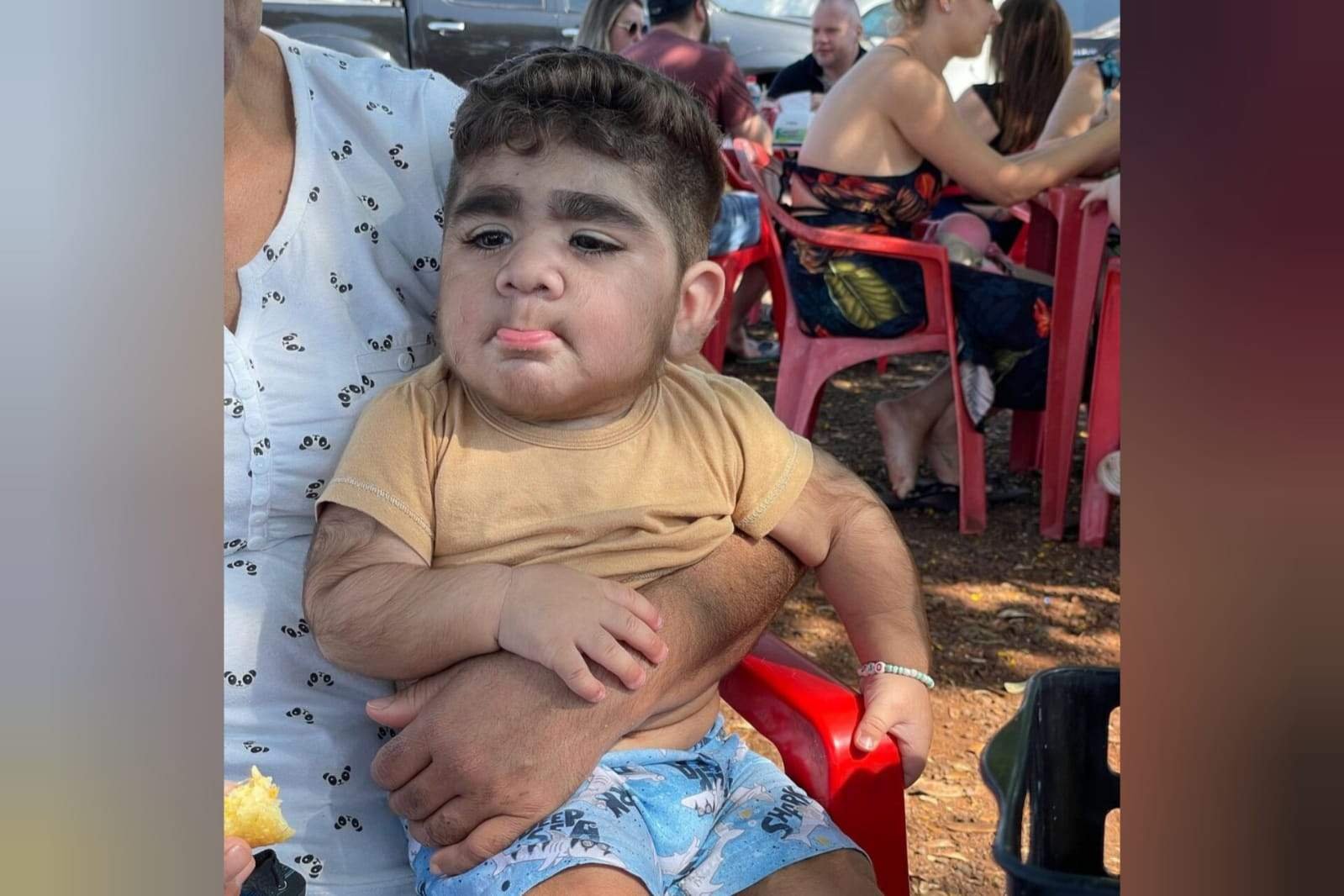 Foto mostra João Miguel, menino que se tornou célebre nas redes sociais, por ter um excesso de pelos e barba - Metrópoles