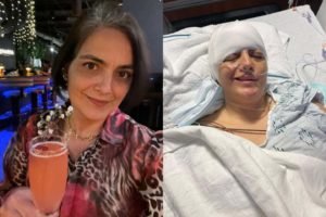 Montagem de fotos mostra Gilmara Bertini durante o tratamento do seu câncer no cérebro da segunda vez que ele se manifestou