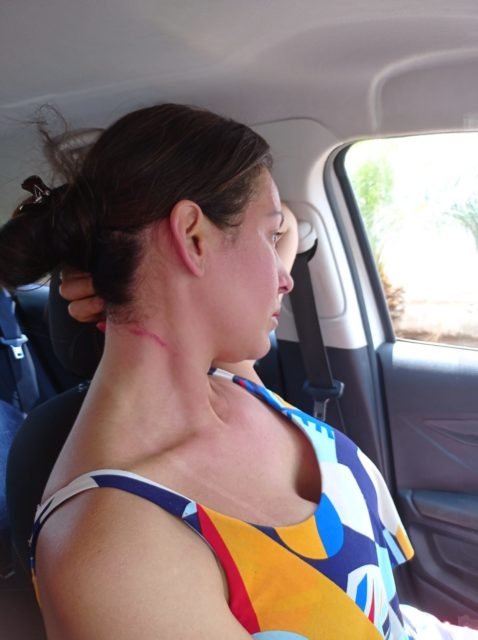Fotos mostram como ficou vítima de violência
