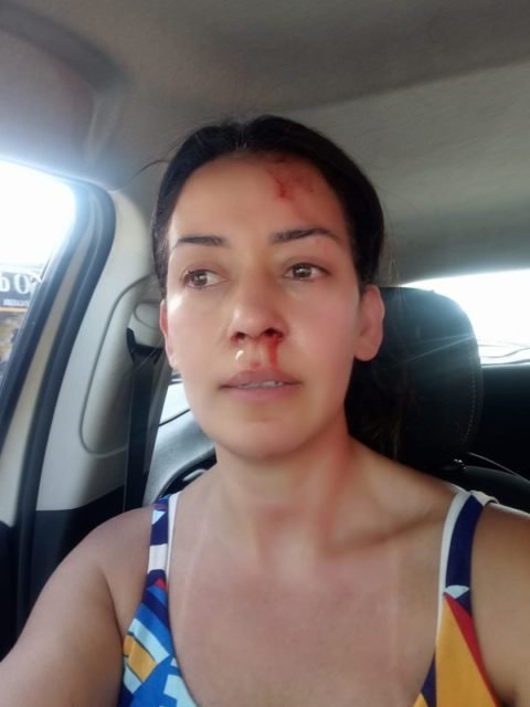 Fotos mostram como ficou vítima de violência
