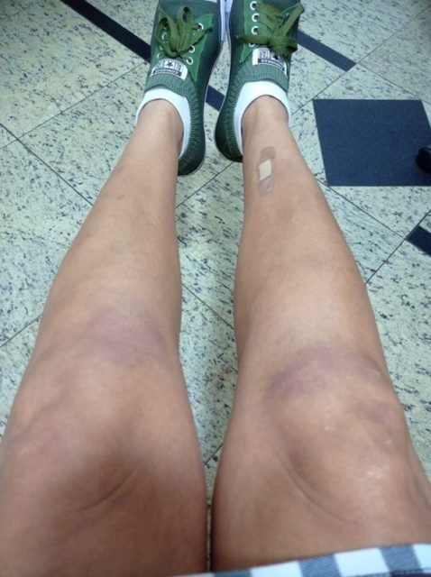 Fotos mostram como ficou vítima de violência