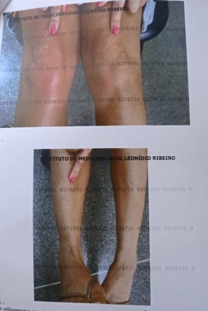 Fotos mostram como ficou vítima de violência