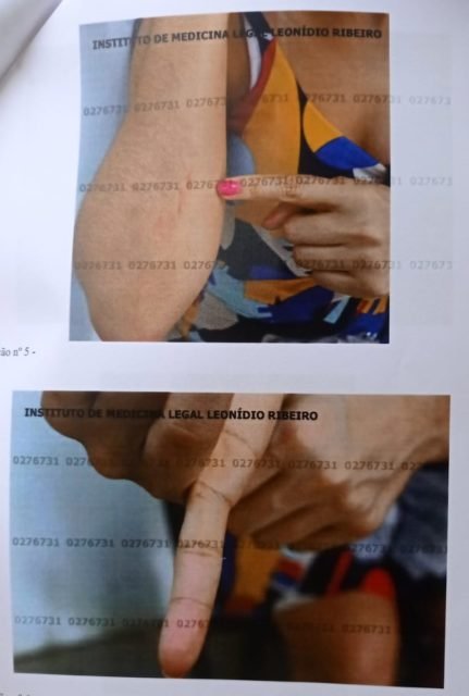 Fotos mostram como ficou vítima de violência