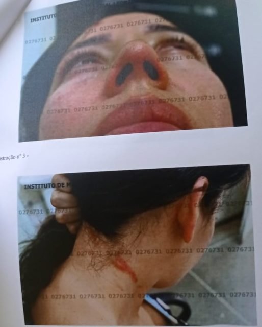 Fotos mostram como ficou vítima de violência